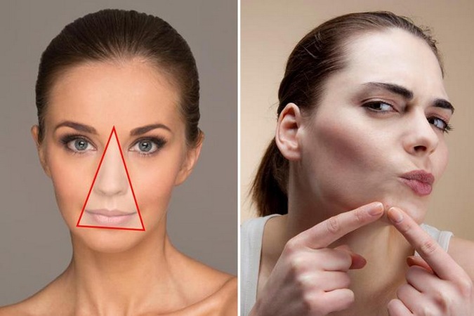 Triangle de la mort: partie du visage que vous ne devez jamais manipuler vos boutons, au risque de subir des conséquences graves