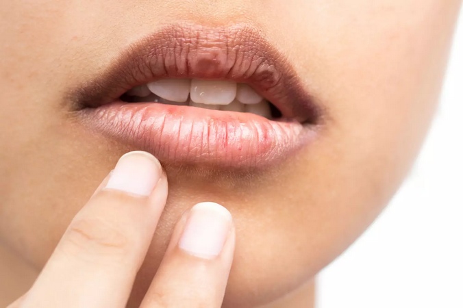 Les remèdes naturelles pour éclaircir les lèvres noircies par le tabac