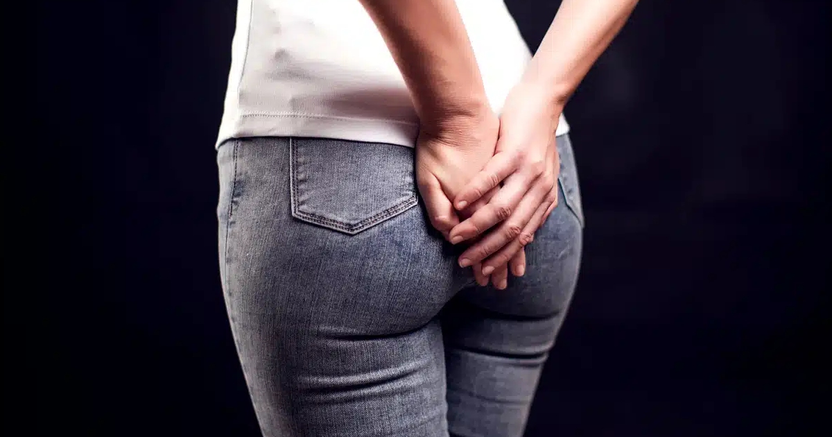 Quatre astuces efficaces pour éliminer définitivement les boutons sur les fesses